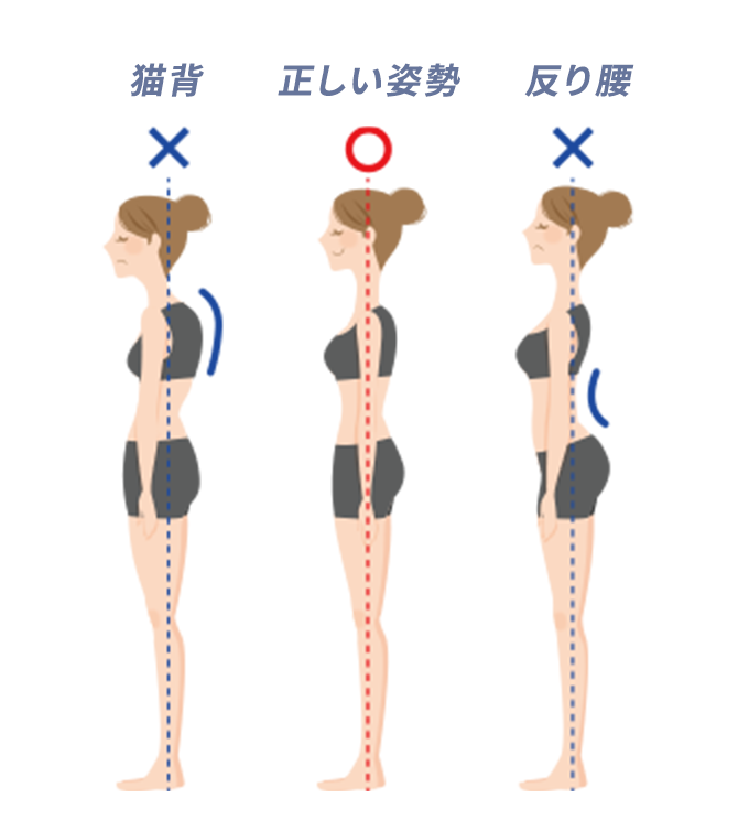 猫背・正しい姿勢・反り腰